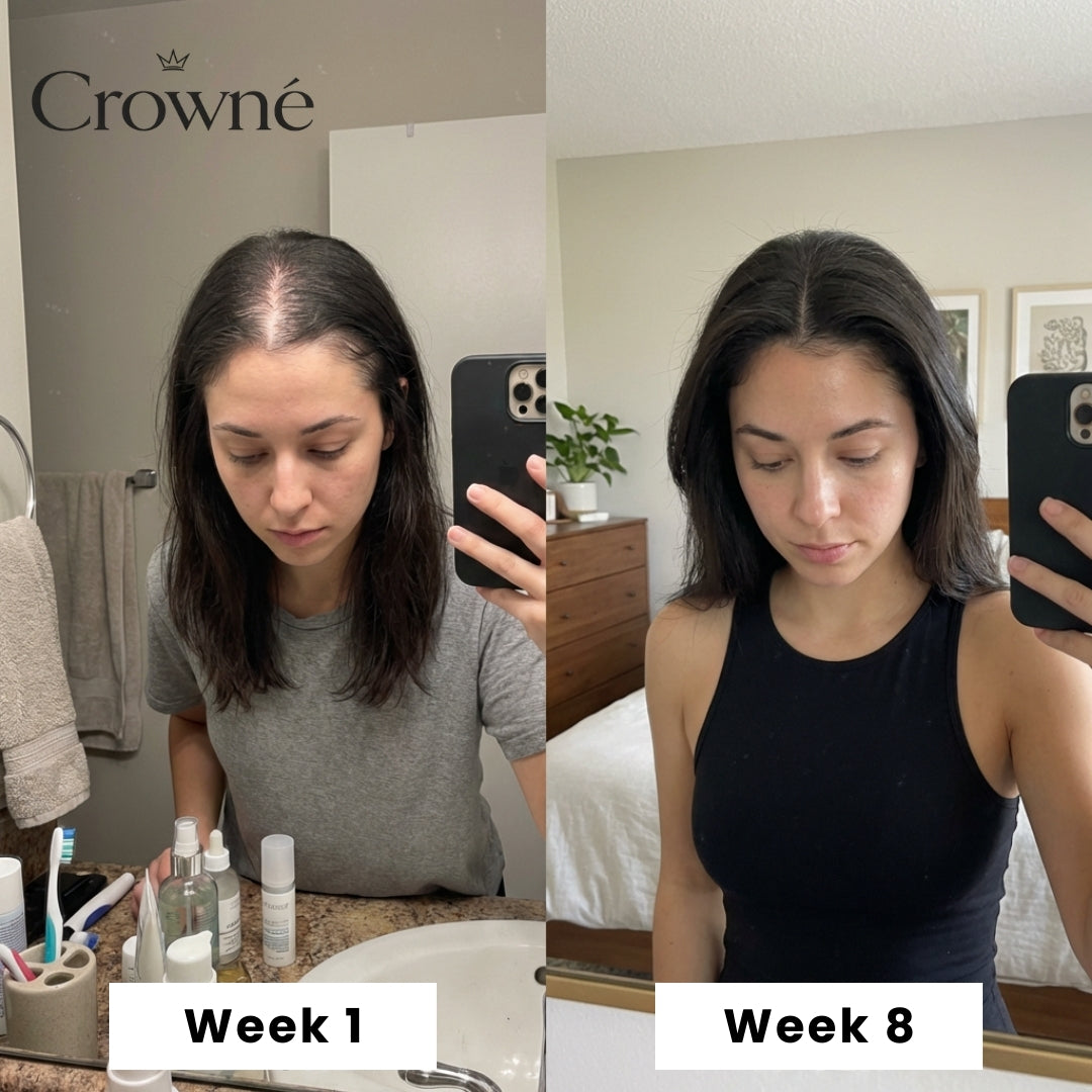 Regrow Visibly Thicker, Fuller Hair - Crowné™ Hair Revival System