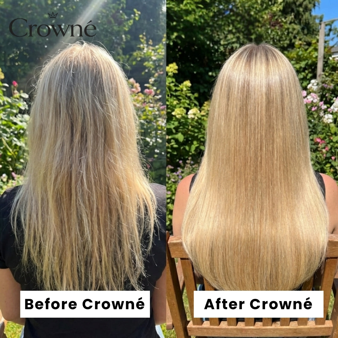 Regrow Visibly Thicker, Fuller Hair - Crowné™ Hair Revival System
