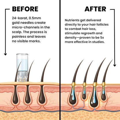 Regrow Visibly Thicker, Fuller Hair - Crowné™ Hair Revival System